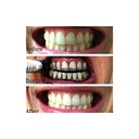  ليزر وايت 1103 مسحوق الفحم الأسود لتبييض الأسنان 20 جرام 